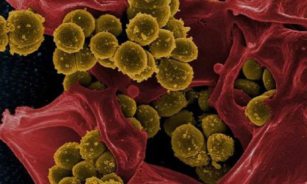 ѩ��������ù����ʲô����ʲôҪʹ�ÿ�����ù����